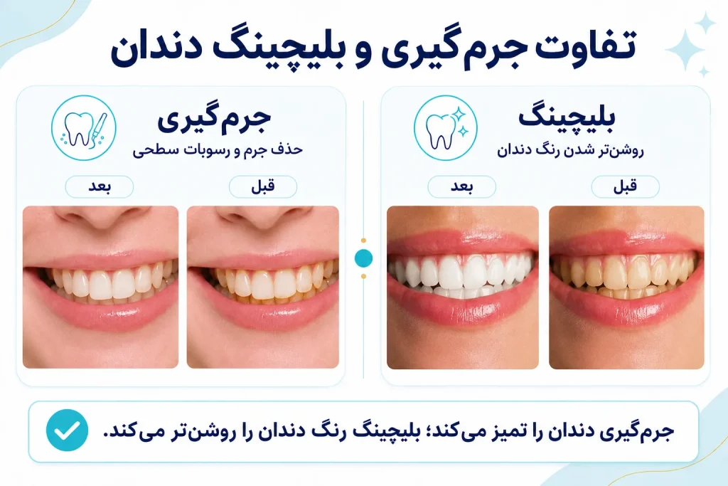 بیلیچینگ و جرم گیری و تفاوت های ان 